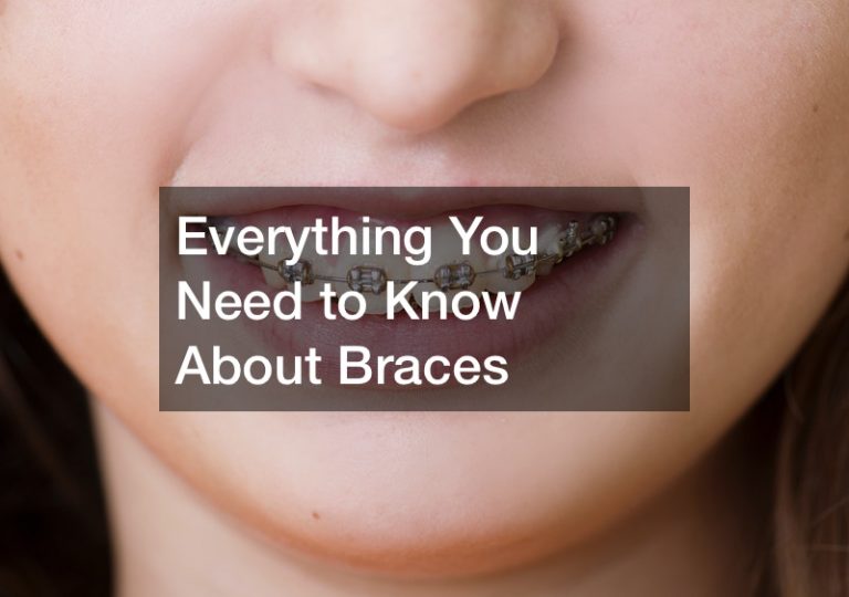 Everything You Need to Know About Braces