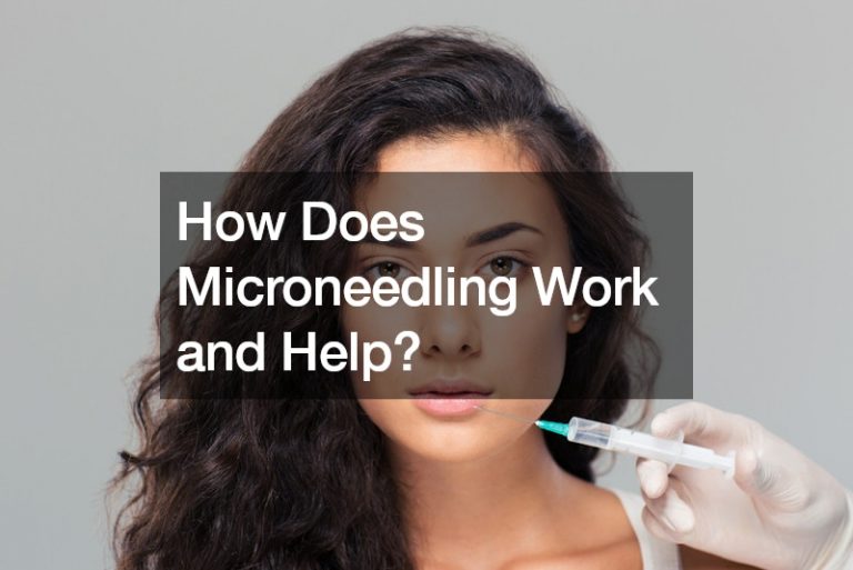 How Does Microneedling Work and Help?